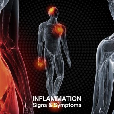  《Understanding Inflammation: A Comprehensive Guide》: 探索身體神秘的火種，引領你走向健康新紀元！