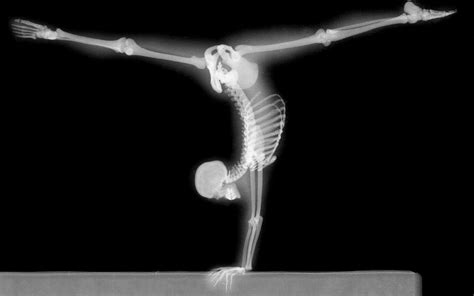  X-Ray Vision: A History Unseen Through Bones